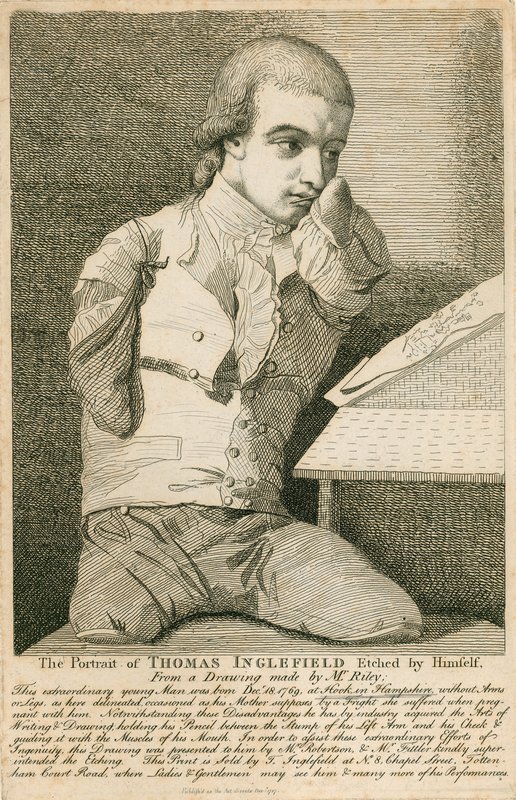 Thomas Inglefield, syntynyt 18. joulukuuta 1769 Hookissa, Hampshiressa, ilman käsiä tai jalkoja tekijältä English School