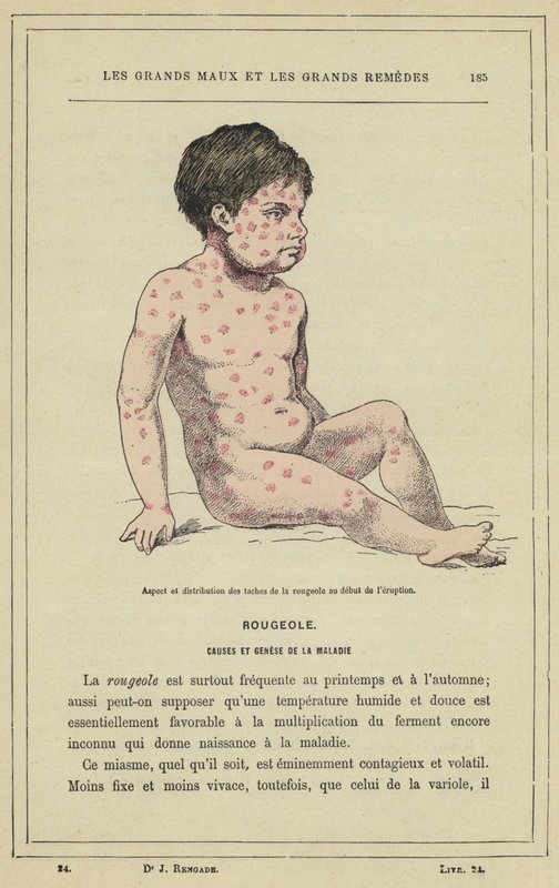 Tuhkarokkopilkkujen ulkonäkö ja jakautuminen purkauksen alkaessa (väri litho) tekijältä French School