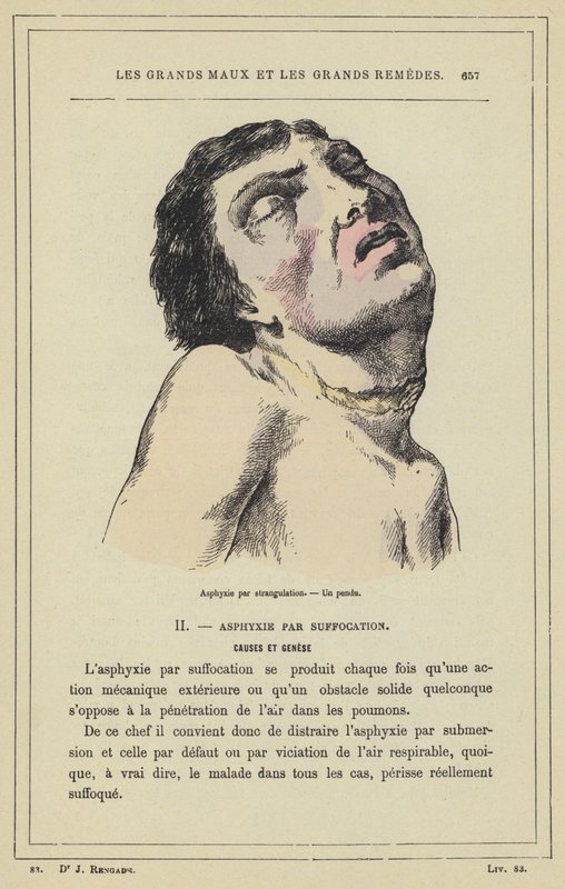 Tukahduttaminen kuristamalla, hirtetty mies (väri litho) tekijältä French School