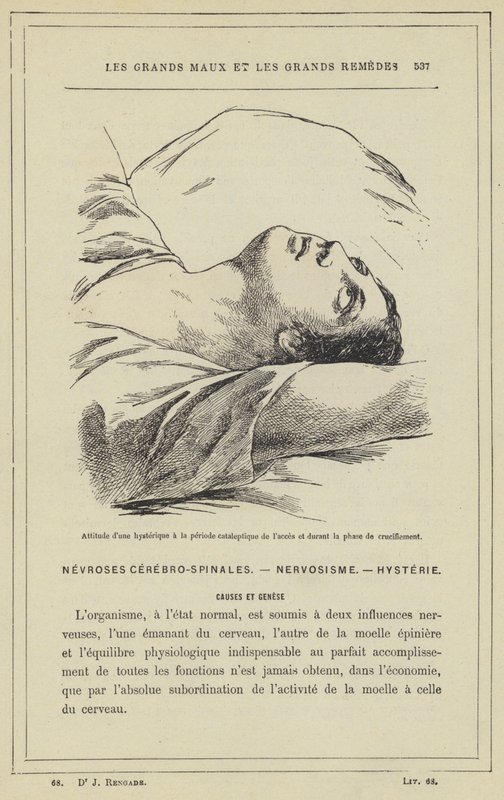 Hysteerisen asenne pääsyn kataleptisen jakson aikana ja ristiinnaulitsemisen aikana (väri litho) tekijältä French School