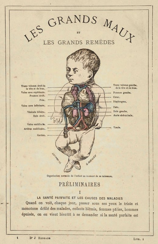 Lapsen normaali organisaatio syntymähetkellä (väri litho) tekijältä French School