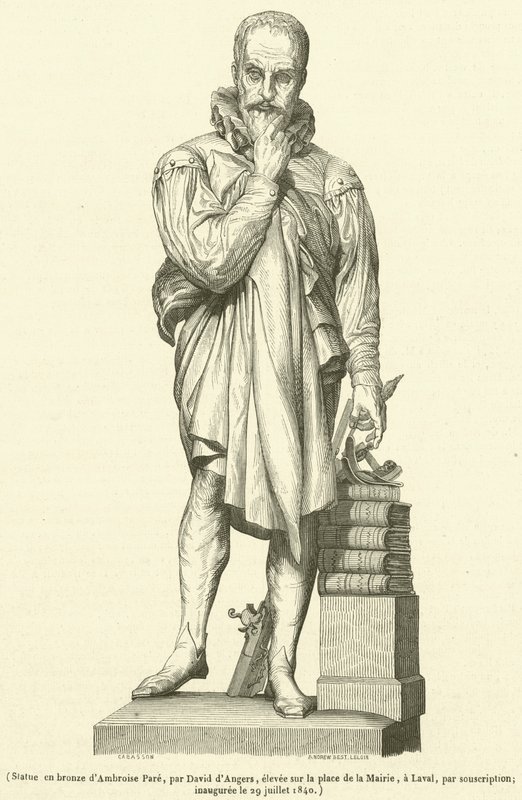 Ambroise Paren pronssinen patsas (kaiverrus) tekijältä French School