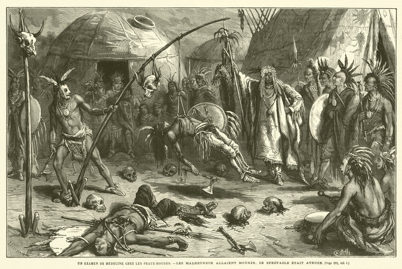 Lääketieteellinen katsaus Redskinsin keskuudessa (kaiverrus) tekijältä French School