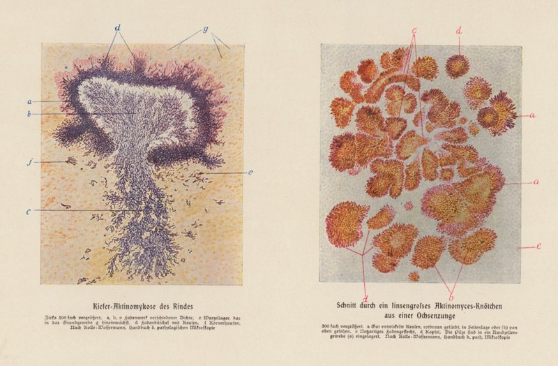 Actinomyces bovis (väri litografia) tekijältä German School