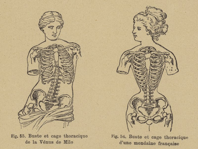 Venus de Milon rinnan ja rintakehän muodon vertailu 1800-luvun lopulla eläneen ranskalaisen sosialistin kanssa tekijältä German School