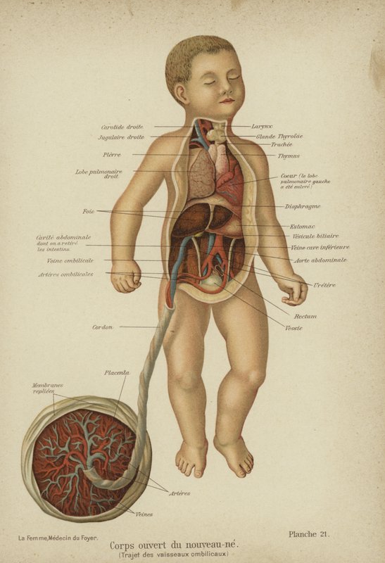 Cutaway-kaavio, joka esittää vastasyntyneen vauvan sisäelimiä ja sen napanuoraa (väri litho) tekijältä German School