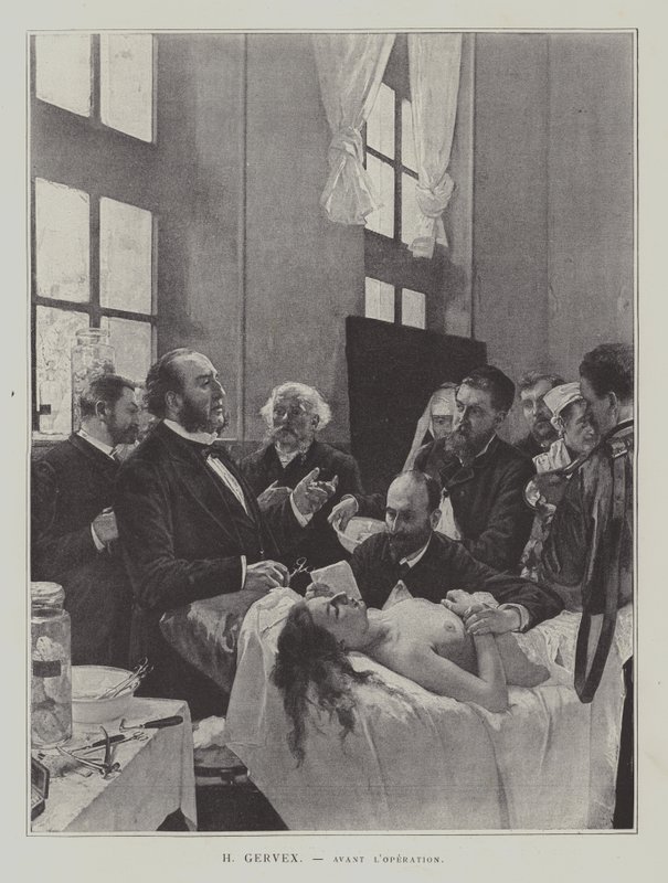 Avant lOperation (ennen käyttöä) tekijältä Henri Gervex