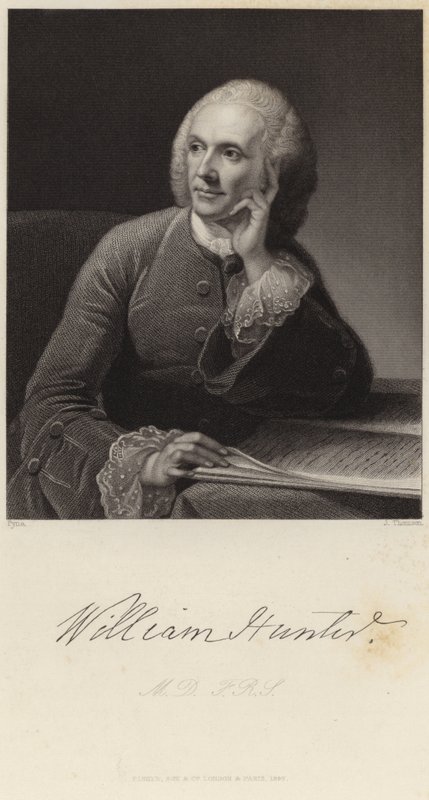 William Hunterin muotokuva tekijältä James Baker Pyne