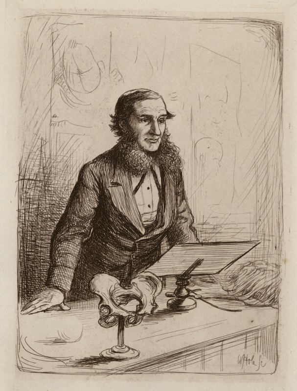 Alexander Russell Simpson, kätilötyön ja naisten ja lasten sairauksien professori (kaiverrus). tekijältä William Brassey (after) Hole
