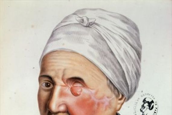 Lackerbauer