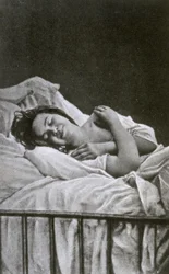 Nuori nainen, jolla on hysteriakohtaus, 1878