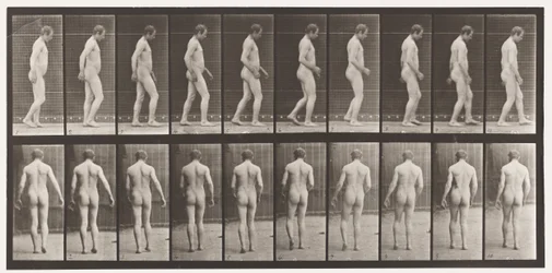 Levy 553. Pään traumatismin jälkeen; Kävely, 1885