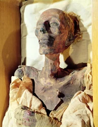 Ramses II:n (1304-1237 eaa.) muumioitunut ruumis, joka löydettiin haudasta Deir el-Bahrista