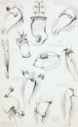 Methods of Arresting Bloeding, n. 1890