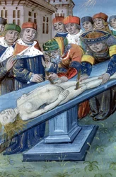 Ms Hunter 9 f.22r Dissektio, De Medina Fen I. II, kirjoittanut Avicenna (980-1037)