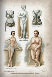 Kauneus ja naisen vartalon epämuodostuma: liian laiha ja lihava nainen, joka on "ihanteellisena naisena" pidetyn Venus de Medicin alapuolella.