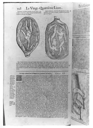 Foetus, kuvitus Ambroise Paren (1509-90) teoksista, julkaistu Lyonissa, 1641
