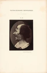 Valokuvasähköfysiologia, kuva 39.