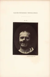 Valokuvasähköfysiologia, kuva 53.