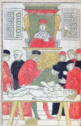 Dissektio, kuvitus Johannes de Kethamin (d.c.1490) Fasciculus Medicinaesta 1493 (puupiirros)