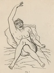 Hysteerinen epilepsia, kohtaus, vääntymät, kuva. 1 teoksesta "Iconographie Photographique de La Salpetriere", Bourneville et P. Regnard, Pariisi, 1876