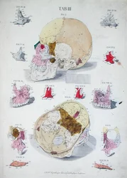 Kallon luut, Christoph Jacob Trew