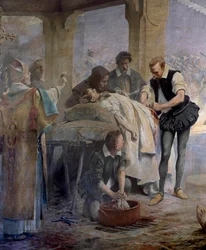 Lääkäri Ambroise Pare (1509-1590) harjoittelee valtimoiden liittämistä harquebusheriin, joka loukkaantui Kaarle V:n Metzin piirityksen aikana vuonna 1553. Detail. Theobald Chartranin maalaus (1849-1907)
