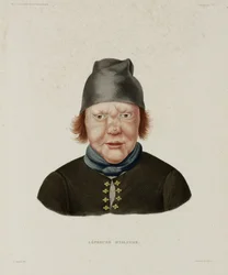 Sairaudet, Lepra Naaraspitaalinen, Islanti, 1800-luvun alku