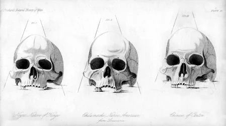 Kolme ihmiskallotyyppiä, 1848