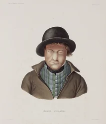 Sairaudet, Lepra Mies spitaalinen, Islanti, 1800-luvun alku