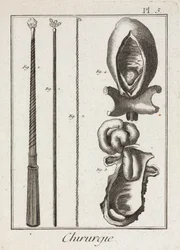 Laitteet, Early-Modern Kirurgiset instrumentit ja kaaviot kehon osista