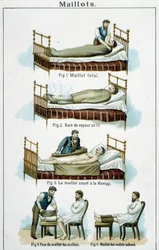 Neulepuserot: 1) Total Jersey, 2) Höyrykylpy sängyssä, 3) Kneipp short jersey, 4-5) Calf jersey - "Bilz, Natural Medication" -sarjassa, 1800-luvun loppu