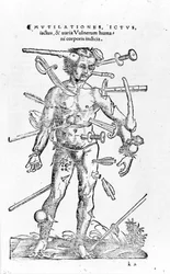 Kaikenlaisia traumaattisia sotavammoja. 16. vuosisata